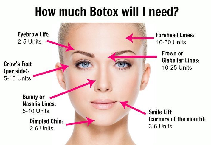 Botox For Anti Aging Wrinkle Treatment