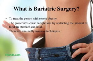 Bariatric Surgery