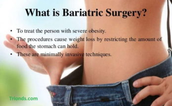 Bariatric Surgery