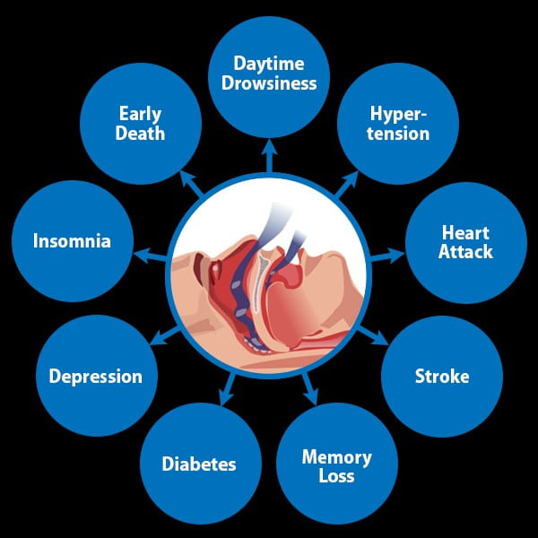 What Issues Can Snoring Cause