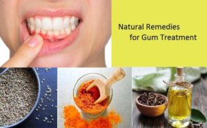 Natural Remedies for Gum Disease