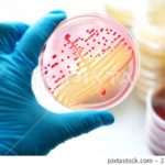 MacConkey Agar