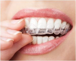 size of your teeth