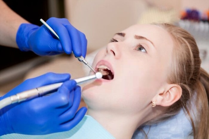 5 Things You Need to Know About Root Canal Treatment