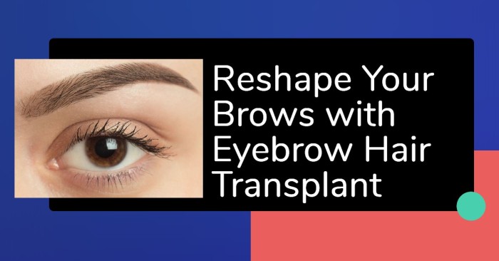 Reshape Your Brows with Eyebrow Hair Transplant