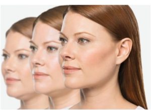Get Rid Of A Double Chin