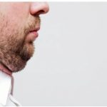 Get Rid of Double Chin