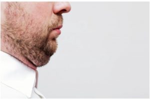 Get Rid of Double Chin