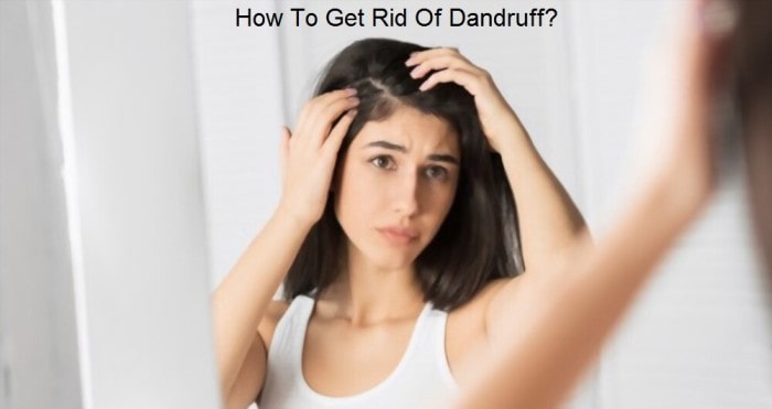 How to Get Rid of Dandruff?