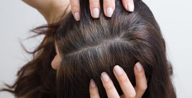 Premature Greying? Follow 5 Natural Home Remedies to Darken The Greys