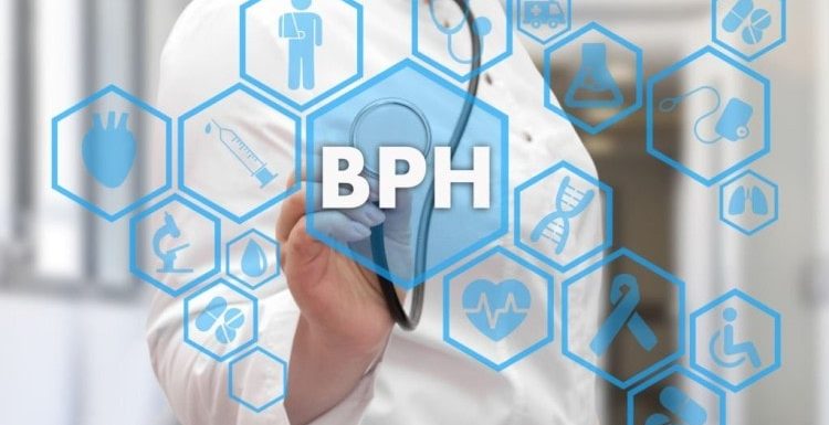 Understanding Benign Prostatic Hyperplasia and Its Effects